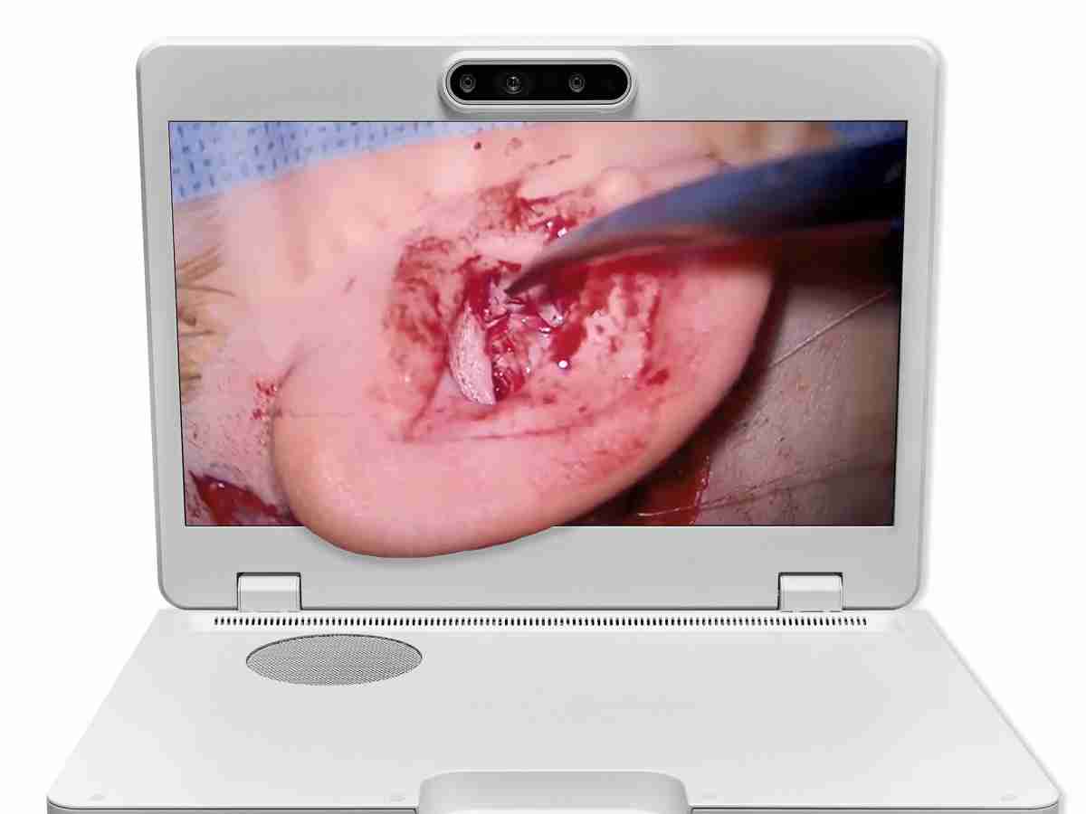 达擎之＂Heads-up 3D显微手术显示系统＂，，，整合4K裸眼3D显示及眼球追踪系统，，具备快速追踪人眼移动位置功能，，，减轻医师长时间维持固定姿势的负担，，，让医师能有更宽广清晰的3D立体视野及更舒适的姿势来执行手术。。